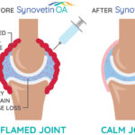 Synovetin OA-Newly Published Research Shows Groundbreaking Joint Treatment Changes
<span class="bsf-rt-reading-time"><span class="bsf-rt-display-label" prefix="Reading Time"></span> <span class="bsf-rt-display-time" reading_time="2"></span> <span class="bsf-rt-display-postfix" postfix="mins"></span></span><!-- .bsf-rt-reading-time -->